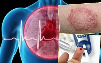 Contraindications para sa lipolifting