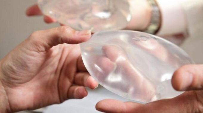 Endoprosthetics ng dibdib
